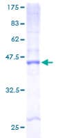 Human CYB561D2 Protein (Recombinant GST)