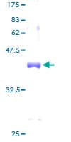 Human SNRPD2 Protein (Recombinant GST)