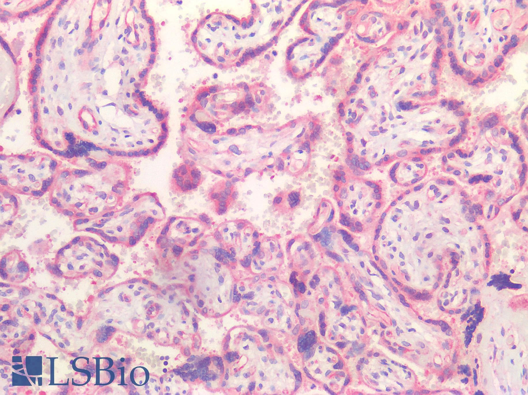 IHC-plus™ Polyclonal Rabbit anti-Human HGF / Hepatocyte Growth Factor Antibody (IHC)
