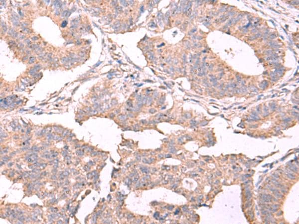 ESM1 / Endocan Antibody
