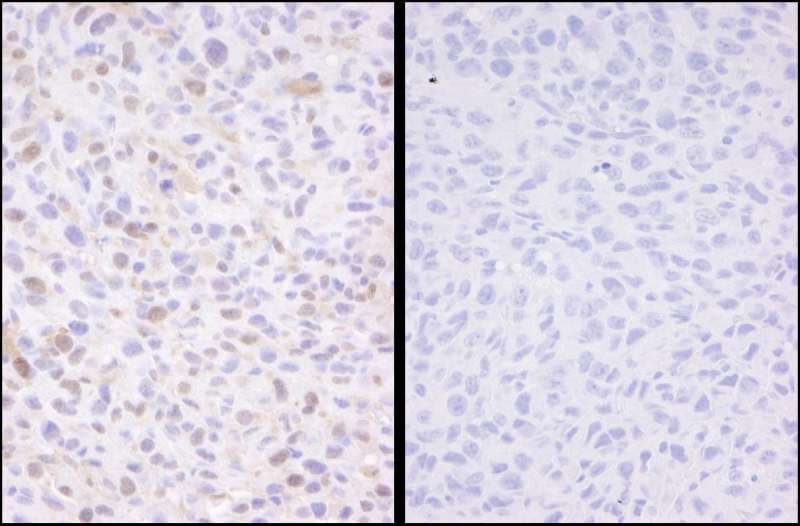 Polyclonal Rabbit anti-Human SMC3 / HCAP Antibody (phospho-Ser1083, IHC)