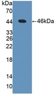 Human Leptin Protein (Recombinant His-GST, N-terminus)
