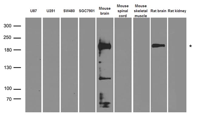 Polyclonal Rabbit anti-Human GRIN2A / NMDAR2A / NR2A Antibody (WB)