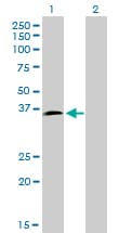 HOXD8 Antibody (clone 10F8)
