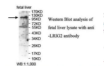 LRIG2 Antibody (aa313-502)