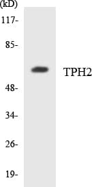 TPH2 Antibody (aa13-62)