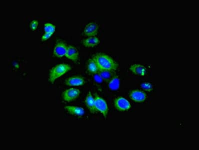 Polyclonal Rabbit anti-Human IFIT5 Antibody (IHC, WB)