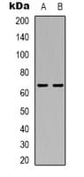 TRIP4 / ASC-1 Antibody (Internal)