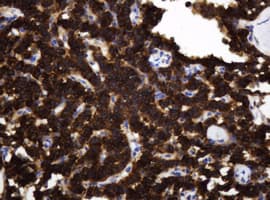 Monoclonal Mouse anti-Human TAPBPL / TAPBPR Antibody (clone OTI3D8, IHC, WB)