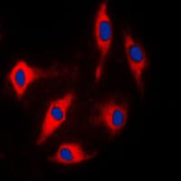 ARHGAP17 / NADRIN Antibody (Internal)