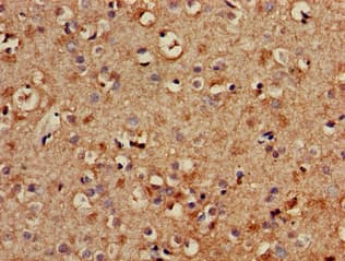 IHC-plus™ TYRO3 Antibody