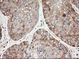 Monoclonal Mouse anti-Human TUBB4 / Tubulin Beta 4 Antibody (clone OTI5C1, IHC, IF, WB)