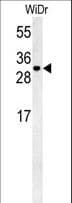 Polyclonal Rabbit anti-Human TM2D3 Antibody (aa22-50, WB)