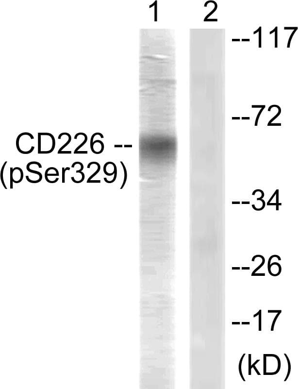 DNAM-1 / CD226 Antibody (phospho-Ser329)