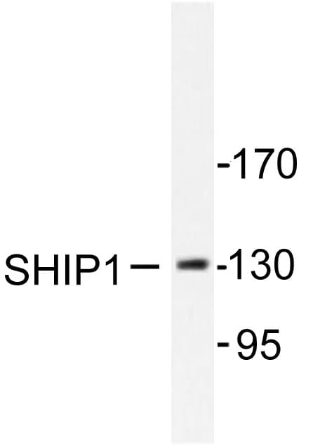 INPP5D / SHIP1 / SHIP Antibody (Met1014)