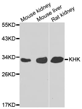 Polyclonal Rabbit anti-Human KHK / Ketohexokinase Antibody (IHC, WB)
