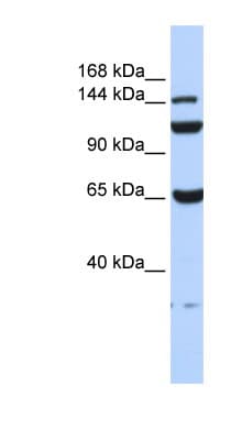 C17orf57 Antibody (aa72-121)