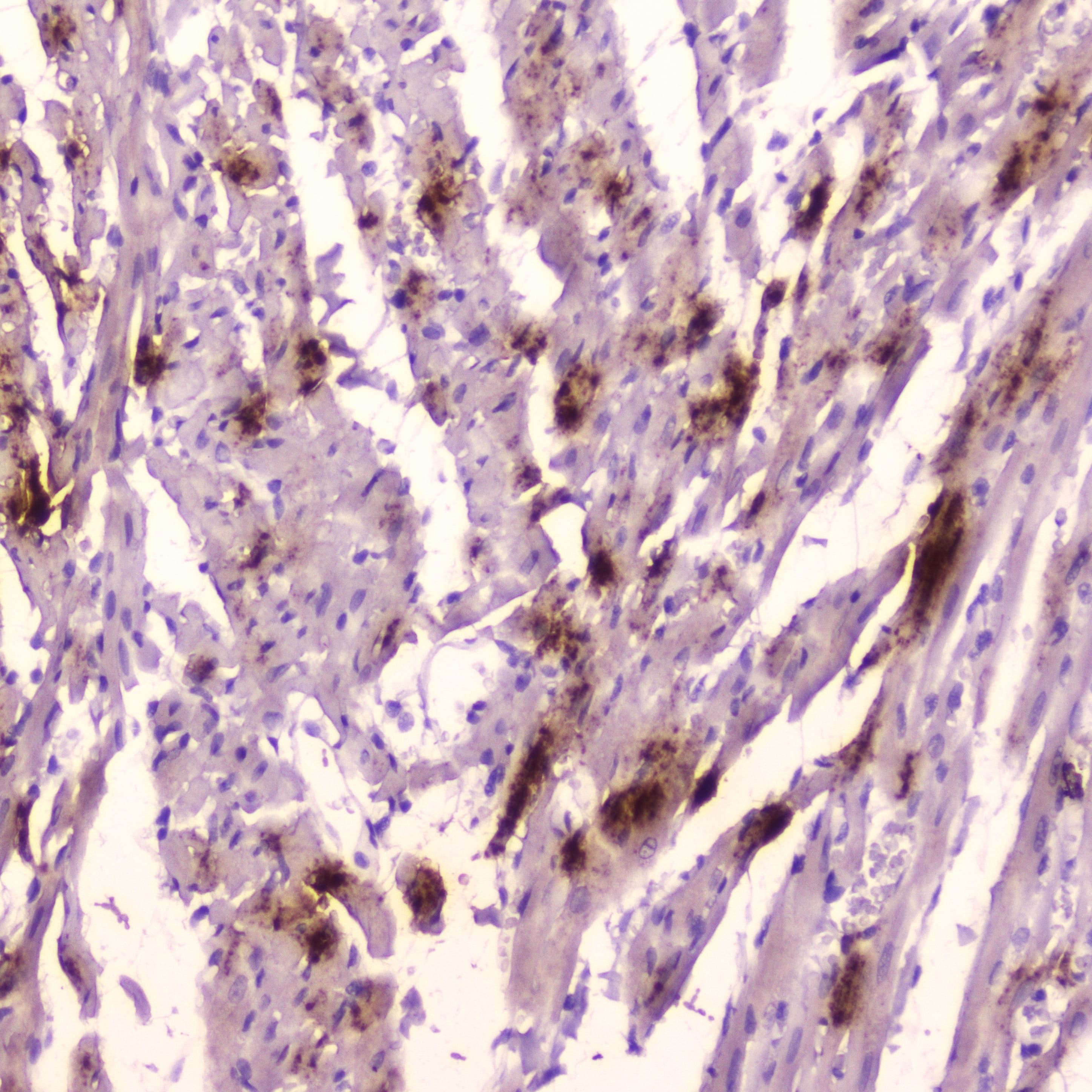 NPPA / ANP Antibody