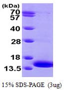 Human LAMTOR3 / MP1 Protein (Recombinant His)