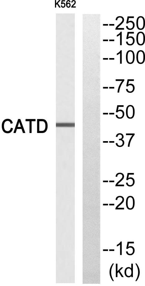 CTSD / Cathepsin D Antibody (light chain, Cleaved-Gln161)