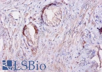 CAST / Calpastatin Antibody (FITC)