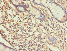 ALDH1A1 / ALDH1 Antibody (aa202-501)