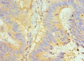 GLRX2 / Glutaredoxin 2 Antibody (aa1-124)
