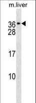 CACNG1 / CACNG Antibody (aa144-172)