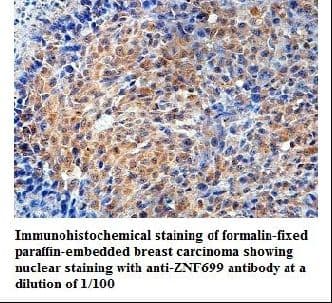 ZNF699 Antibody (aa271-545)