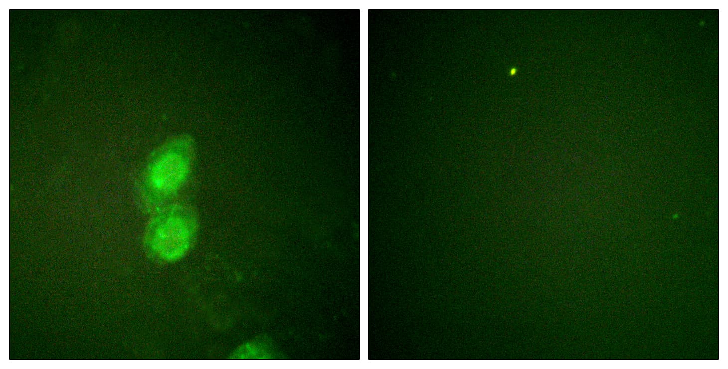 CTNND1 / p120 Catenin Antibody (phospho-Tyr228)