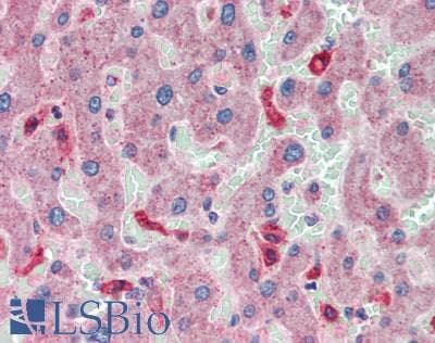 ANGPTL8 / Betatrophin Antibody (aa16-198)