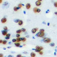 HMG20A Antibody