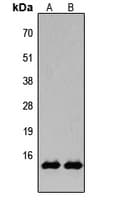 Histone H2B Antibody (Acetyl-Lys15)