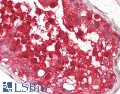 IHC-plus™ Monoclonal Mouse anti-Human WIPI2 Antibody (clone 2A2, aa427-445, IHC, IF, WB)