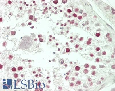 IHC-plus™ CENPH / CENP-H Antibody (aa136-162)