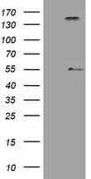 Monoclonal Mouse anti-Human INHA / Inhibin Alpha Antibody (clone OTI12F11, aa62-232, WB)