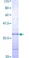 Human DAP12 Protein (Recombinant GST, N-terminus)