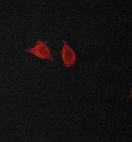 Polyclonal Rabbit anti-Human MAP1LC3B / LC3B Antibody (IHC, IF, WB)