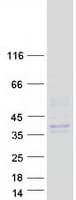 Human KLK3 / PSA Protein (Recombinant Myc-DDK (Flag))