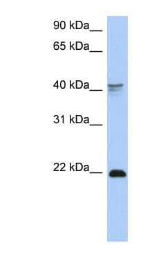 BP1 / DLX4 Antibody (C-Terminus)