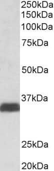 IHC-plus™ Polyclonal Goat anti-Human SPP1 / Osteopontin Antibody (aa288-299, IHC, WB)