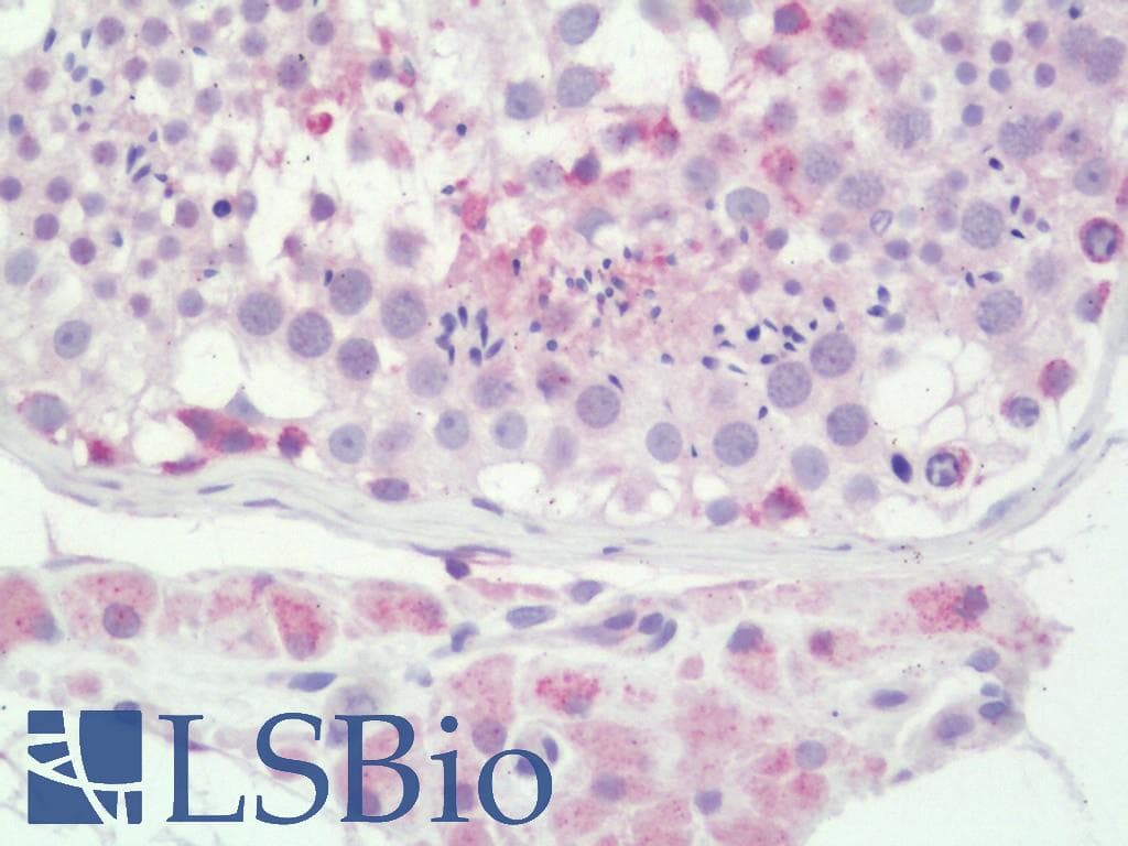 FOXP2 Antibody (clone 11C1034)