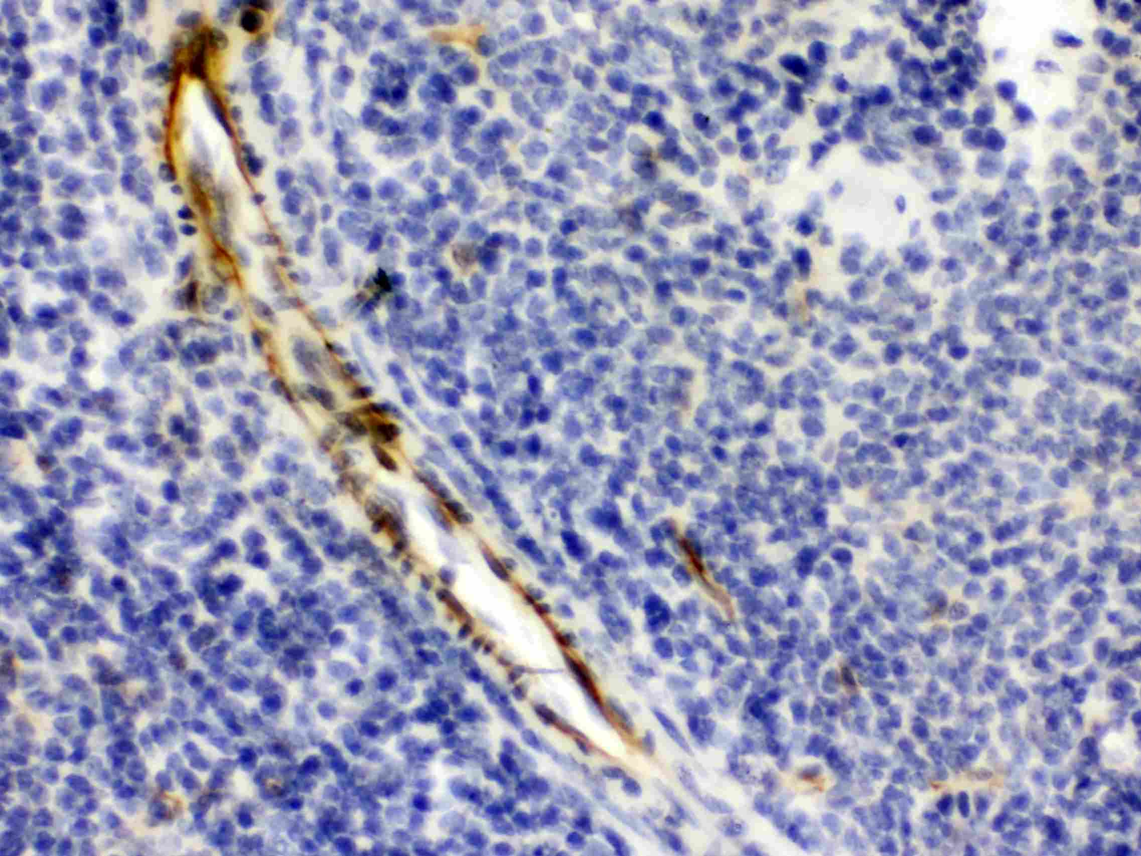 CRYAA / Alpha A Crystallin Antibody
