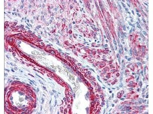 Polyclonal Rabbit anti-Human MYL12A / MRCL3 Antibody (phospho-Ser19/20, IHC, WB)