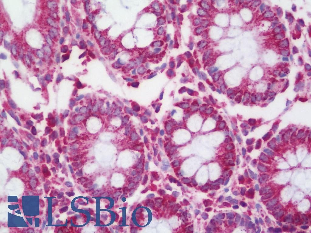 IHC-plus™ IRS2 / IRS-2 Antibody (aa1288-1338)