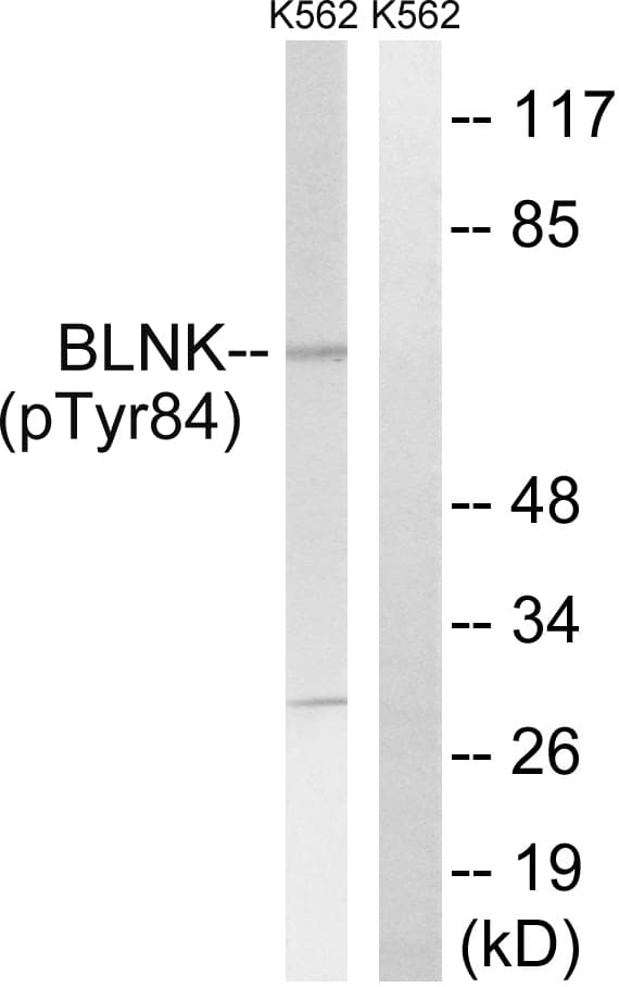 Polyclonal Rabbit anti-Human BLNK Antibody (phospho-Tyr84, IHC, WB)