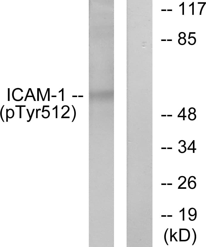 Polyclonal Rabbit anti-Human ICAM-1 / CD54 Antibody (phospho-Tyr512, WB)