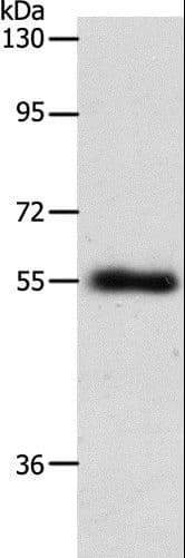 SLC1A5 / ASCT2 Antibody