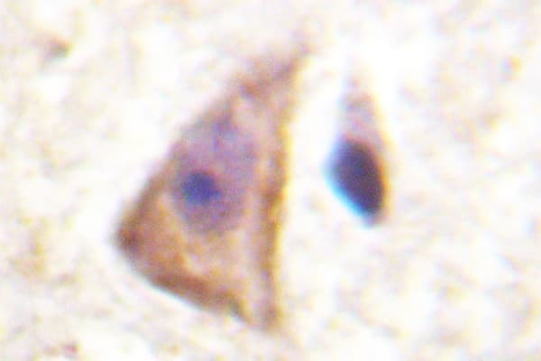 Polyclonal Rabbit anti-Human MAP2K4 / MKK4 Antibody (Gln253, IHC, IF)
