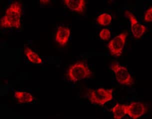 Polyclonal Rabbit anti-Human YWHAE / 14-3-3 Epsilon Antibody (IF, WB)